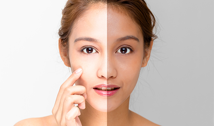  SKIN WHITENING  TREATMENT Full Guide 2022 